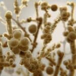 Candida albicans