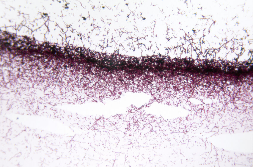 Candida albicans and its biofilms